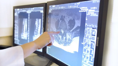 Radiology Advanced