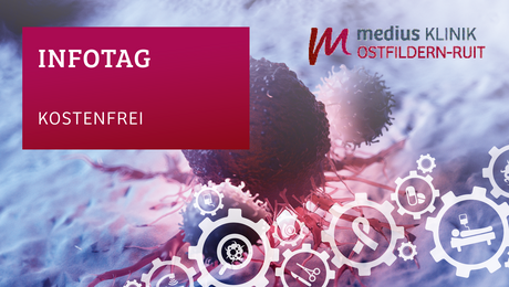 Bild von einer Krebszelle