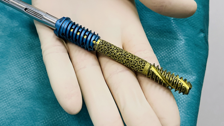 3D Schraube Wirbelsäulenchirurgie