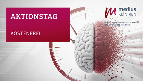 Gehirn mit Uhr als Symbol für Aktionstag Schlaganfall der medius KLINIKEN