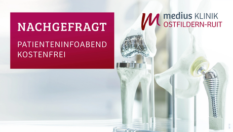 Künstliche Gelenke als Symbol für Veranstaltung zum Thema Endoprothetik an der medius KLINIK OSTFILDERN-RUIT